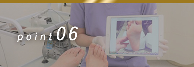 ポイント6