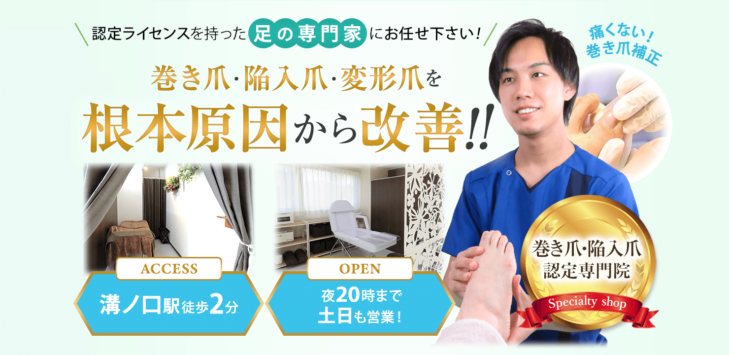 巻き爪・陥入爪・変形爪を根本原因から改善！溝ノ口駅徒歩2分、夜20時まで・土日も営業！
