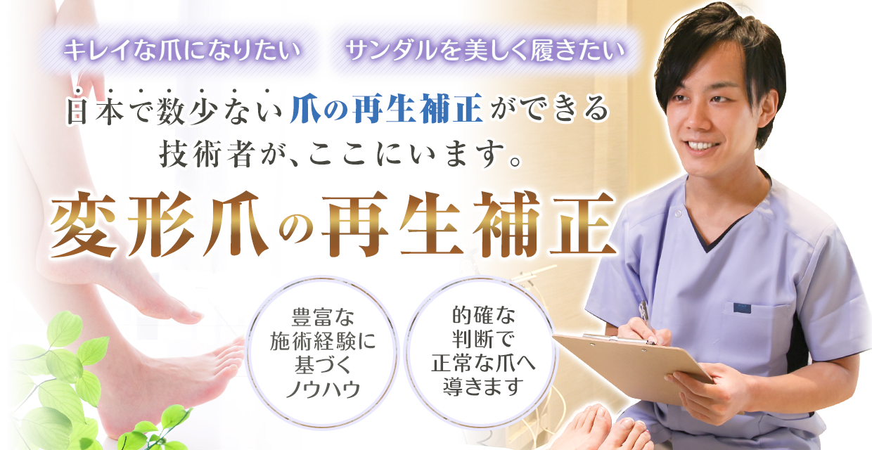 変形爪の再生補正