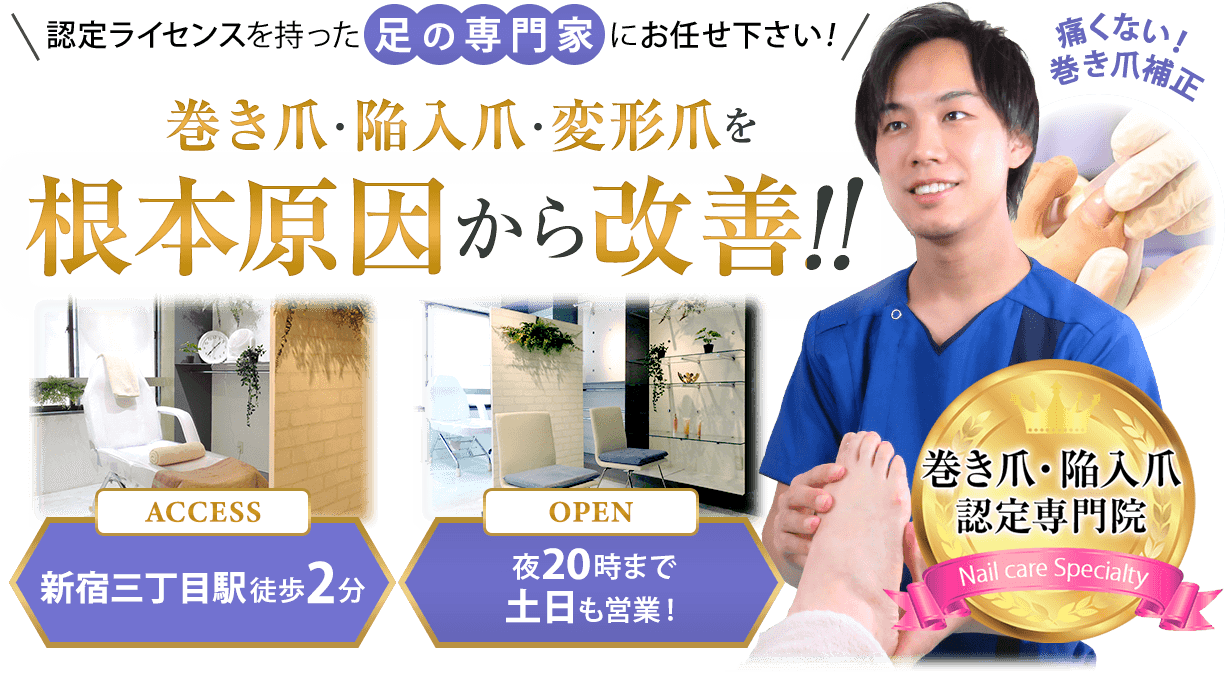 巻き爪・陥入爪・変形爪を根本原因から改善！新宿御苑前駅徒歩2分、夜20時まで・土日も営業！