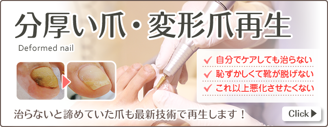 分厚い爪・変形爪再生