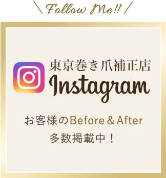 東京巻き爪補正店Instagram。お客様のビフォーアフター多数掲載中