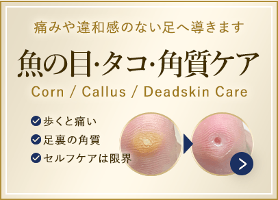 魚の目・タコ・角質ケア