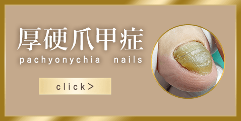 厚硬爪甲症