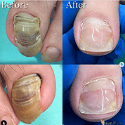 インスタボタン01