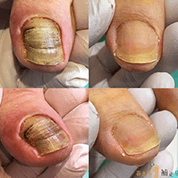 インスタボタン02