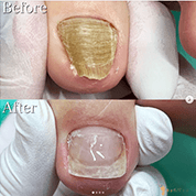 インスタボタン03