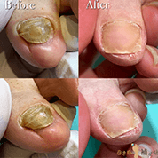 インスタボタン04